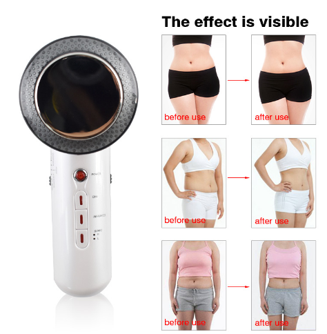 body sculpt 3 in 1 pro device for skin tightening fat reduction and cellulite smoothing, ultrasonic cavitation radio frequency body contouring machine for waist arms and thighs, at home body sculpting device for toning firming and slimming results trending beauty tech USA by Shuntia Symonette