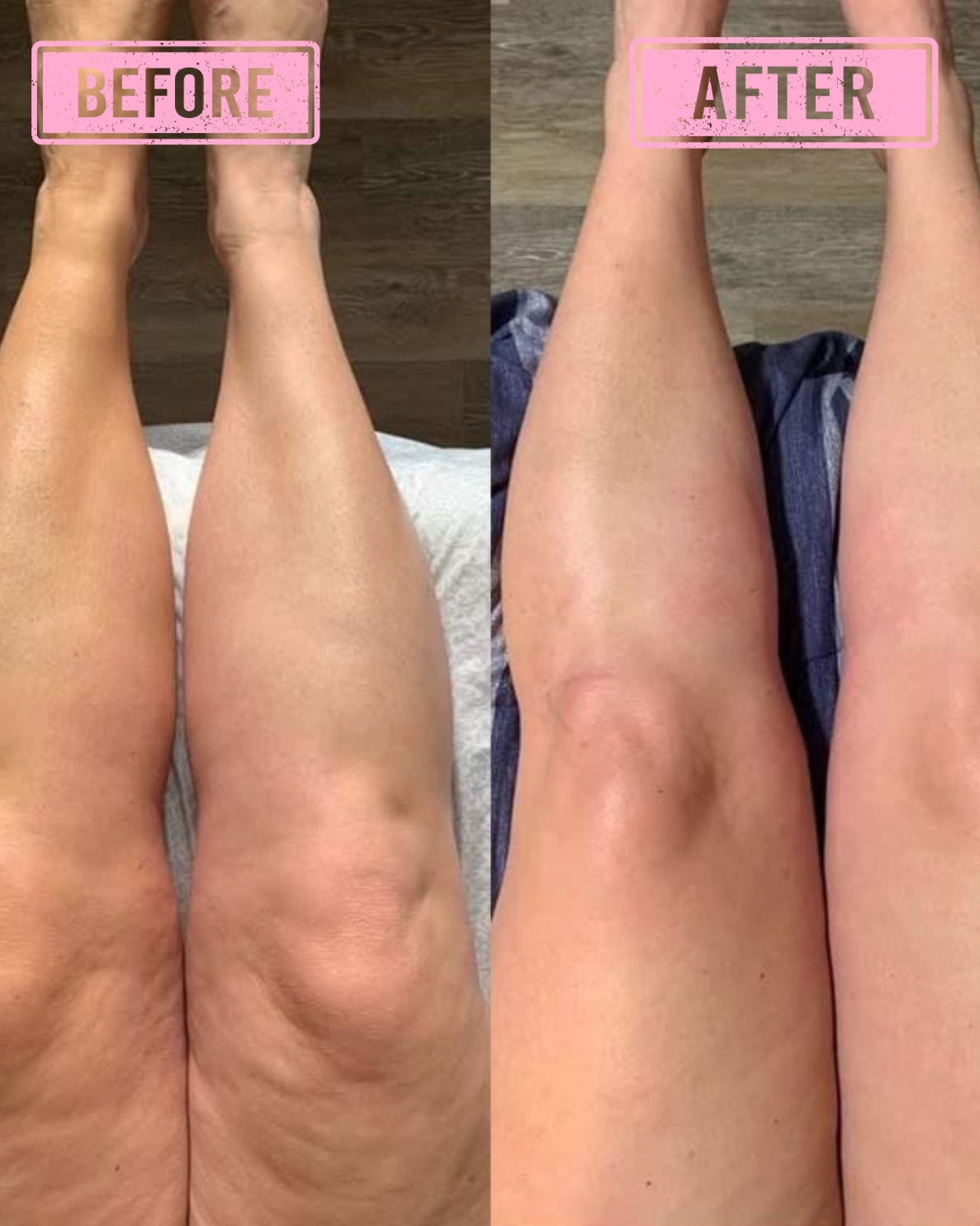 Shuntia Symonette Body Sculpt Cream for cellulite and stretch marks in a glossy pink floral jar with roses, pearls, and firming skincare