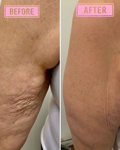 Shuntia Symonette Body Sculpt Cream for cellulite and stretch marks in a glossy pink floral jar with roses, pearls, and firming skincare