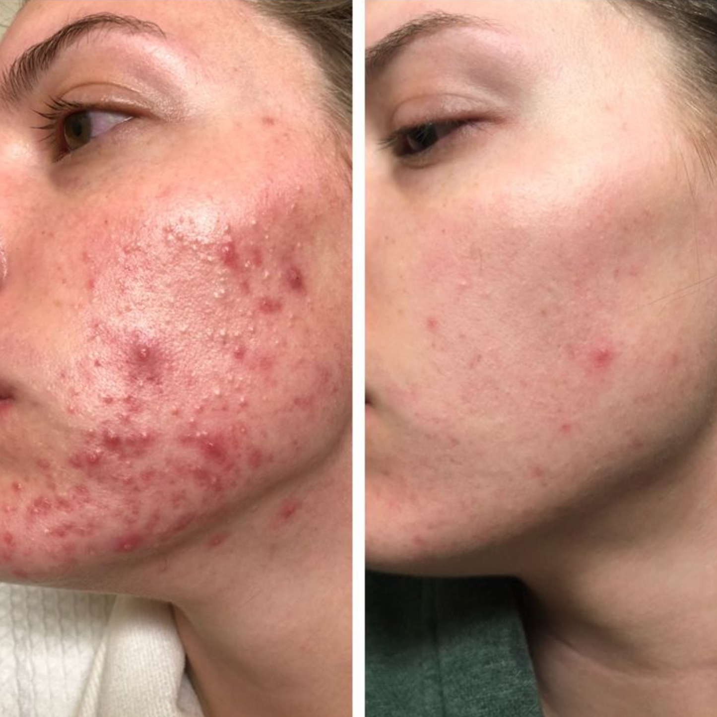 collagen cream best collagen face cream skin firming moisturizer anti aging cream for wrinkles hydrating collagen moisturizer boost skin elasticity reduce fine lines youthful glowing skin skincare collagen boosting cream daily face moisturizer beauty cosmetic skincare by Shuntia Symonette
