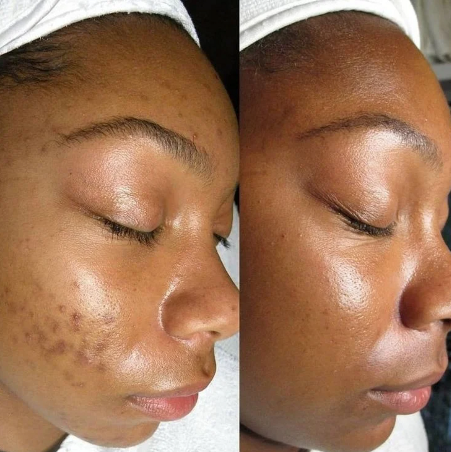 collagen cream best collagen face cream skin firming moisturizer anti aging cream for wrinkles hydrating collagen moisturizer boost skin elasticity reduce fine lines youthful glowing skin skincare collagen boosting cream daily face moisturizer beauty cosmetic skincare by Shuntia Symonette