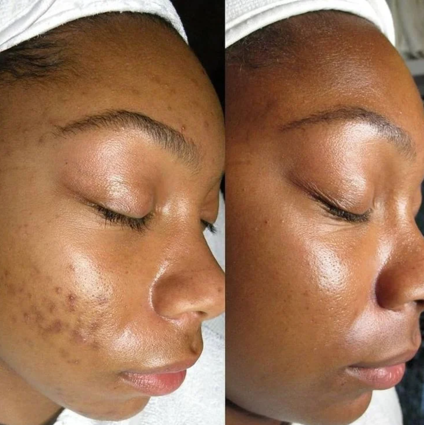 collagen cream best collagen face cream skin firming moisturizer anti aging cream for wrinkles hydrating collagen moisturizer boost skin elasticity reduce fine lines youthful glowing skin skincare collagen boosting cream daily face moisturizer beauty cosmetic skincare by Shuntia Symonette