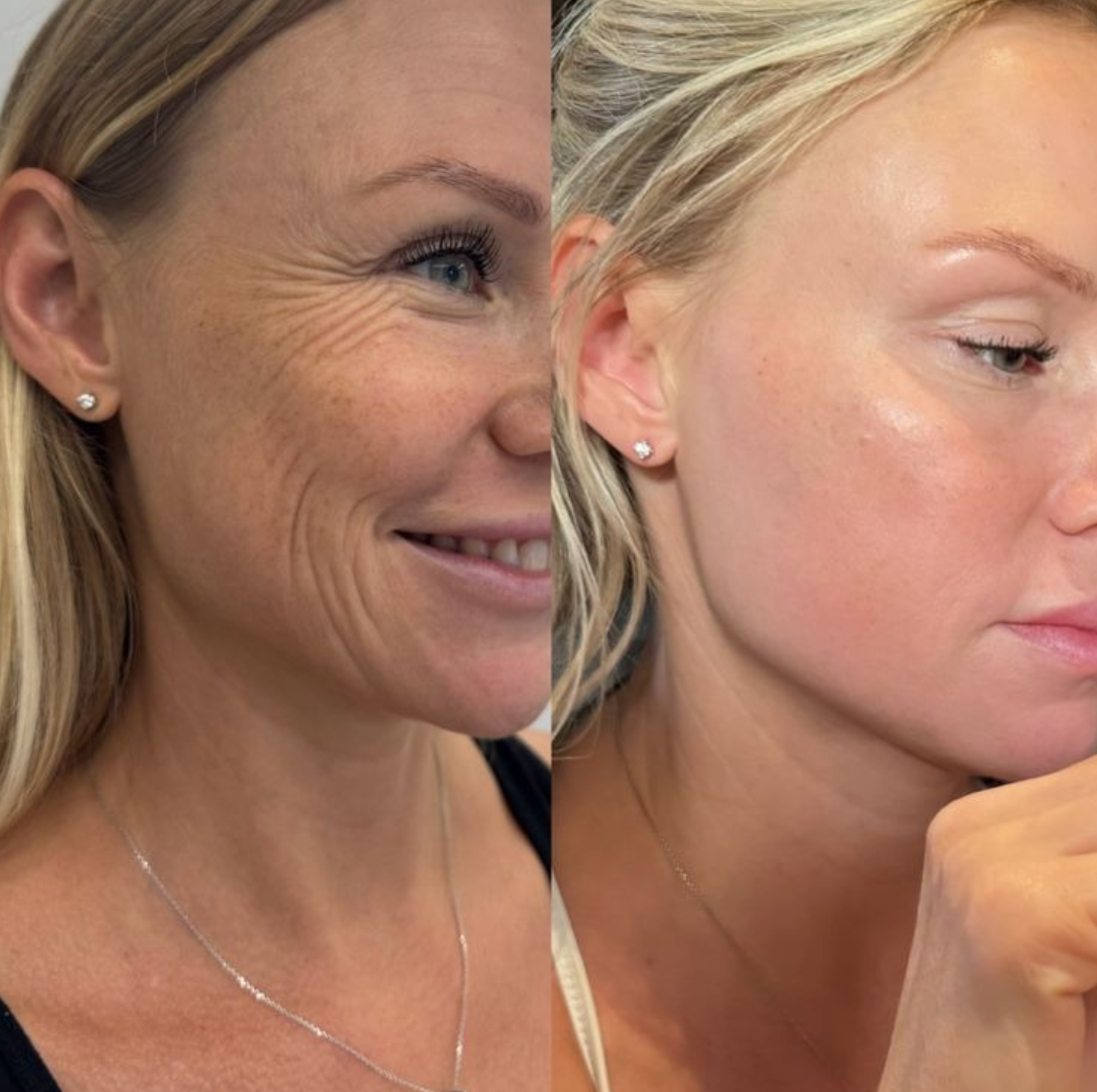 collagen cream best collagen face cream skin firming moisturizer anti aging cream for wrinkles hydrating collagen moisturizer boost skin elasticity reduce fine lines youthful glowing skin skincare collagen boosting cream daily face moisturizer beauty cosmetic skincare by Shuntia Symonette