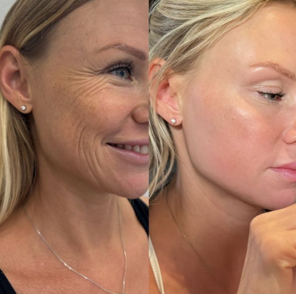collagen cream best collagen face cream skin firming moisturizer anti aging cream for wrinkles hydrating collagen moisturizer boost skin elasticity reduce fine lines youthful glowing skin skincare collagen boosting cream daily face moisturizer beauty cosmetic skincare by Shuntia Symonette