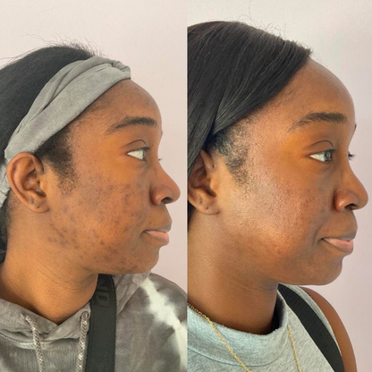 Dark Spot Serum
