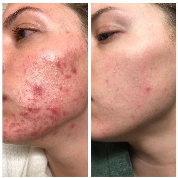 Dark Spot Serum