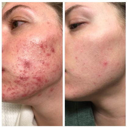 Dark Spot Serum