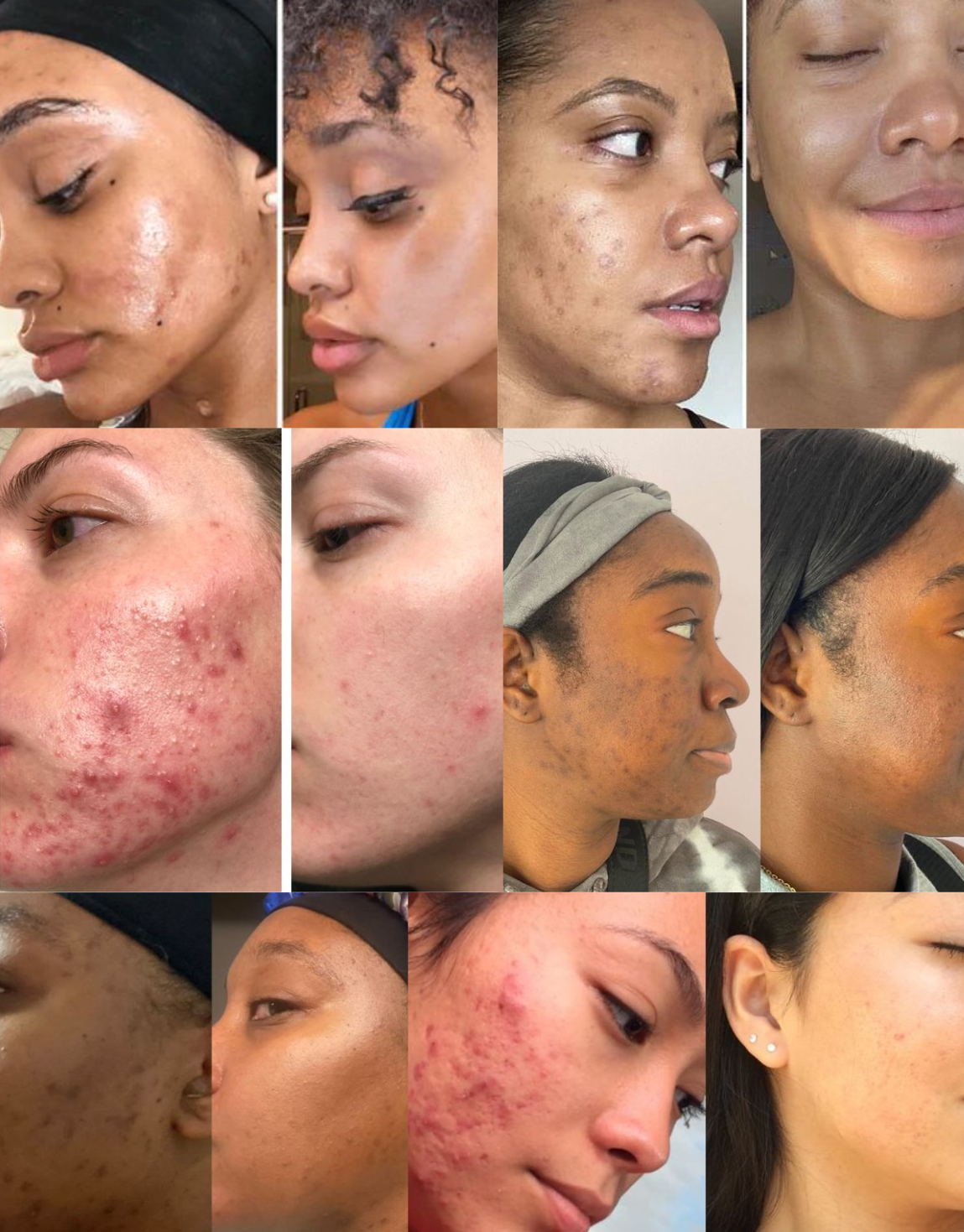 Whipped Grass-Fed Tallow Balm with Vanilla Bean - Shuntia Symonette