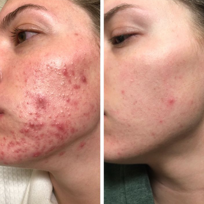 Recovery Cream - Shuntia Symonette