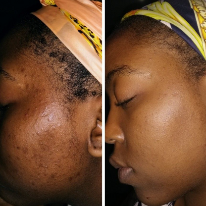 Pro Aging Nourishing Face Cream - Shuntia Symonette