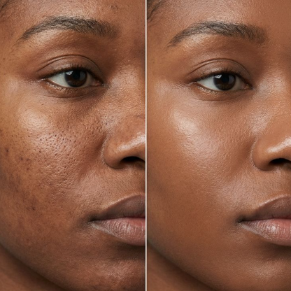 Sea Moss Mud Mask - Shuntia Symonette