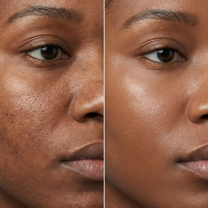 Hair, Skin and Nails Strips