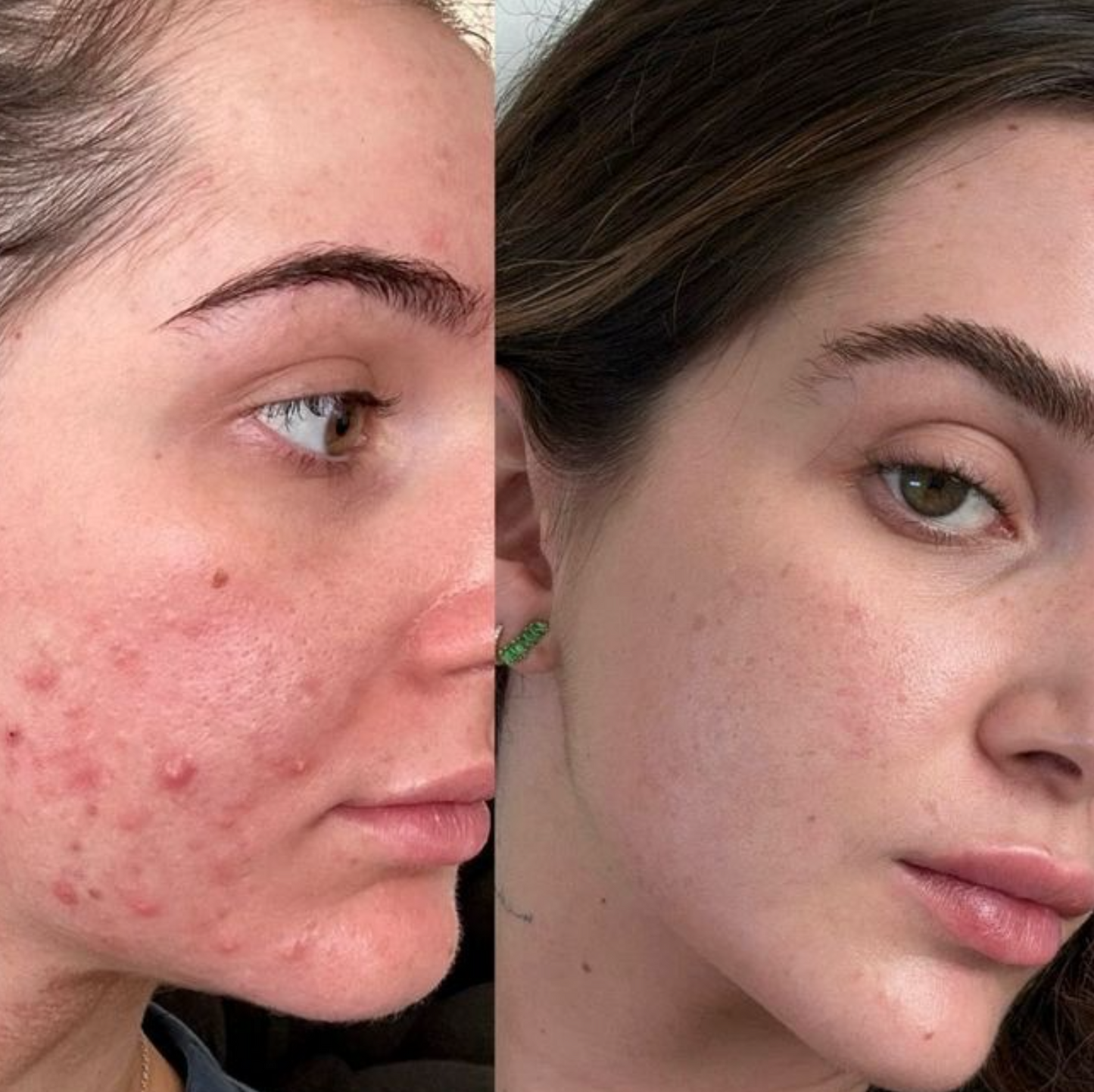 Hair, Skin and Nails Strips