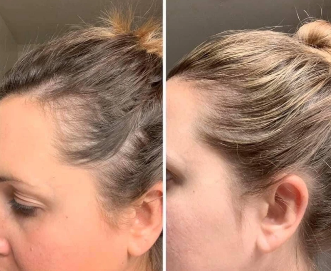 Peptide Hair Growth Serum