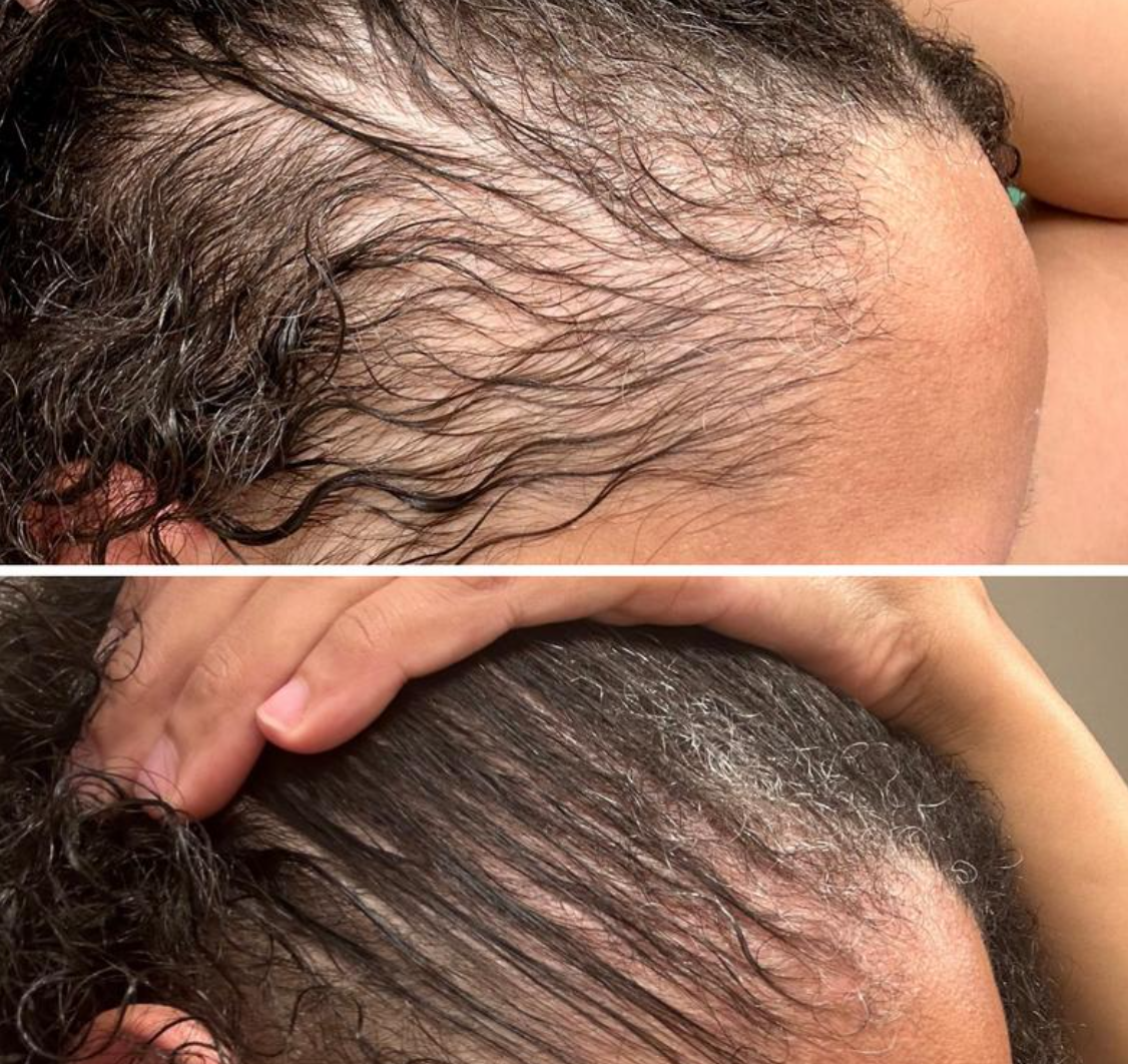 Peptide Hair Growth Serum
