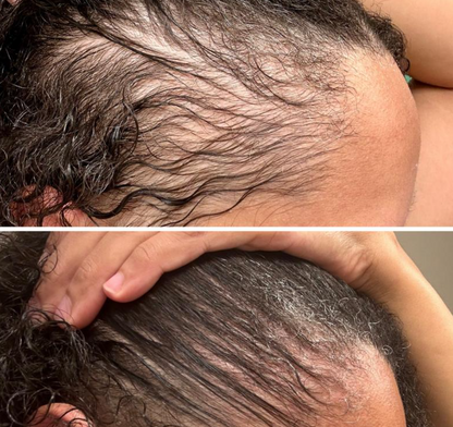 Peptide Hair Growth Serum