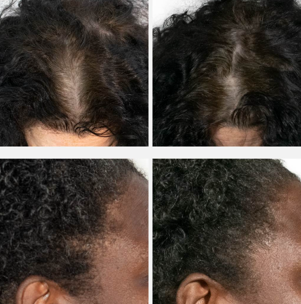 Peptide Hair Growth Serum