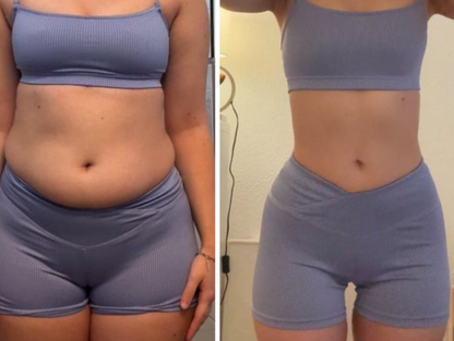 Diet Appetite Weight Loss Strips 360°