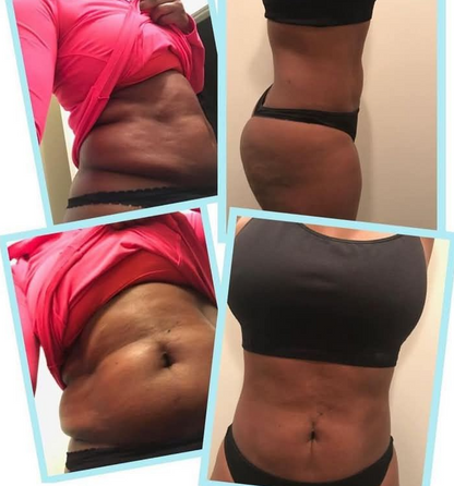 Diet Appetite Weight Loss Strips 360°