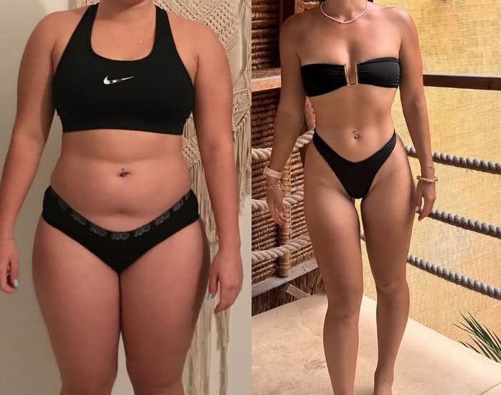 Diet Appetite Weight Loss Strips 360°