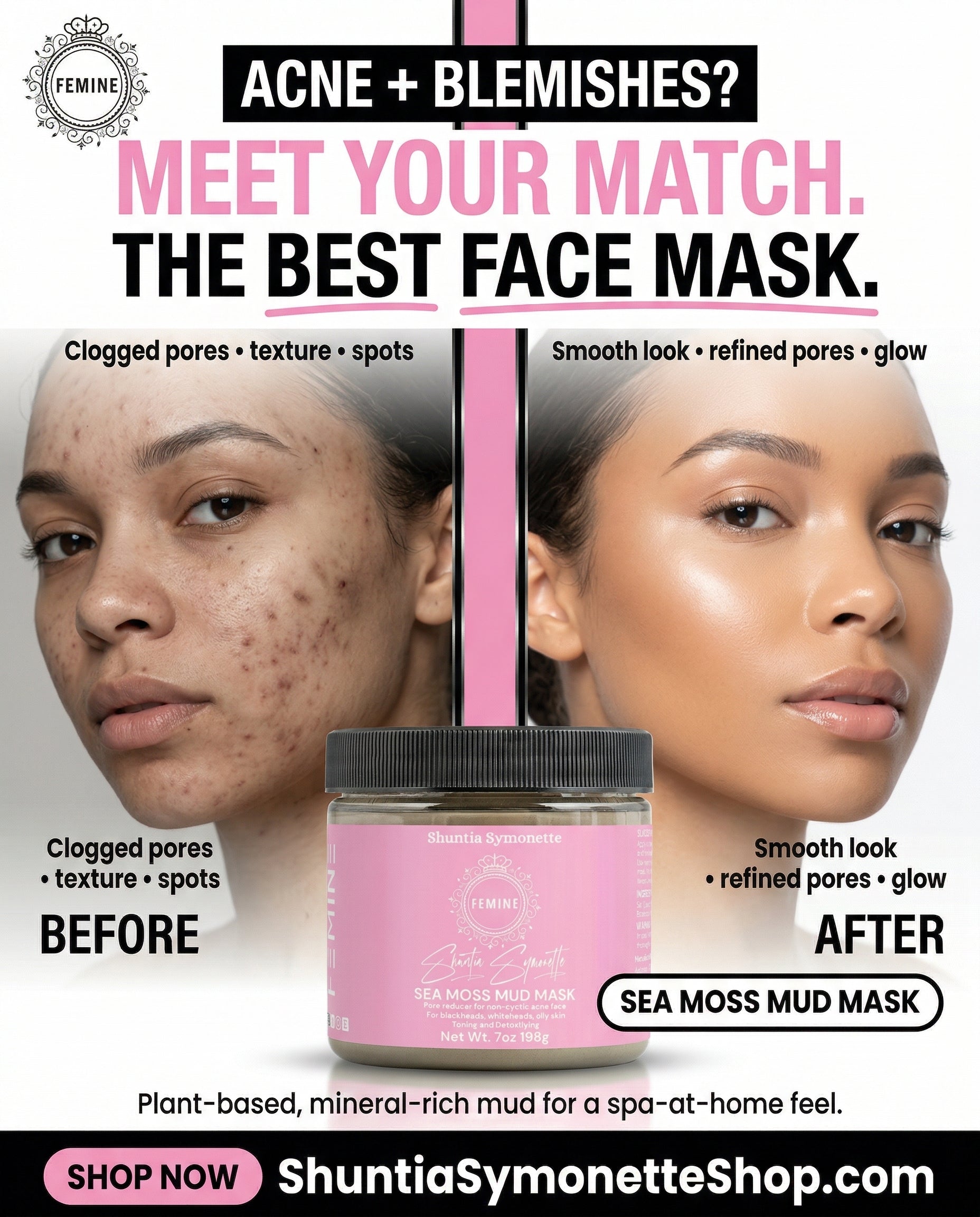 sea moss mud mask detox face mask sea moss skincare deep cleansing mask for pores acne treatment mask hydrating facial mask mineral rich skincare glowing skin face mask oil control mask blackhead removal mask natural beauty cosmetic face mask clear skin treatment by Shuntia Symonette